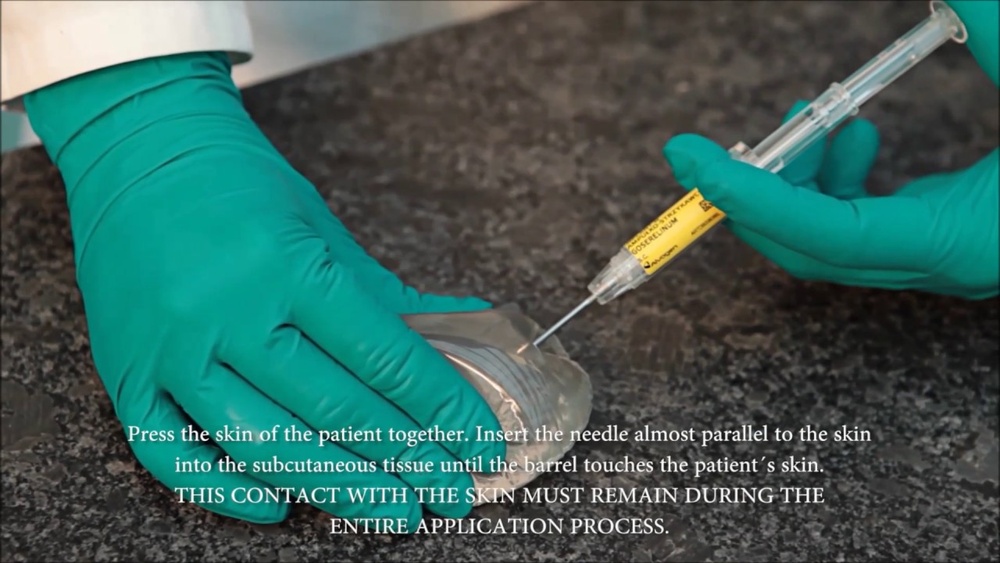 reseligo-implant-3-6-mg