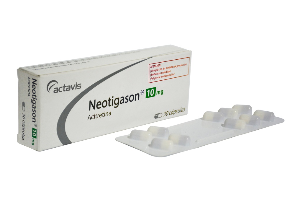 NEOTIGASON