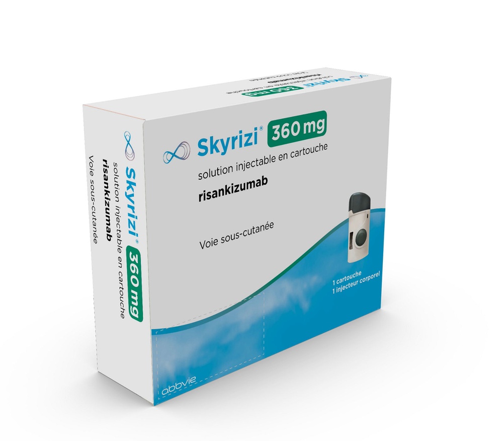 SKYRITSI